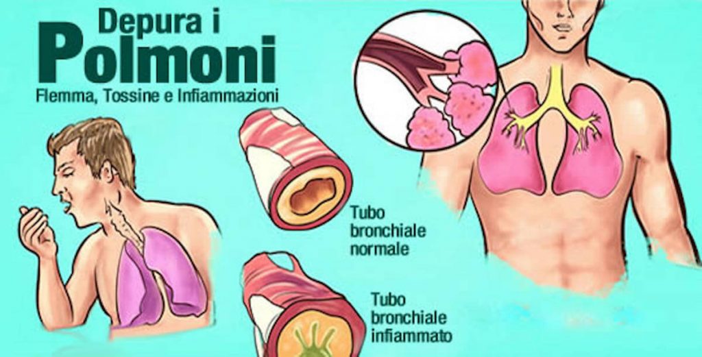 Muco catarro flemma bronchite